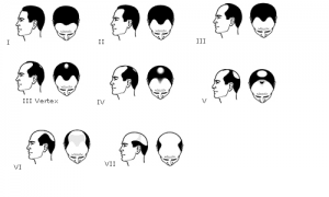 fig-3-classif-aagm